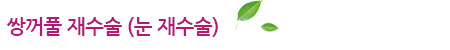 쌍꺼풀 재수술(눈 재수술)