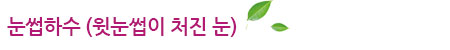 눈썹하수(윗눈썹이 처진 눈)