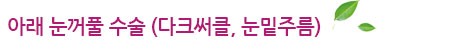 아래 눈꺼풀 수술(다크써클,눈밑주름)